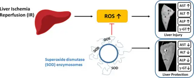 Superoxide Dismutase