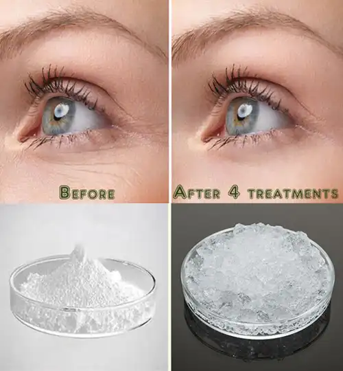 Hyaluronic acid powder Hyaluronic acid powder