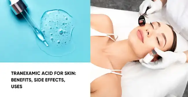 Tranexamic Acid for skin Tranexamic Acid for skin