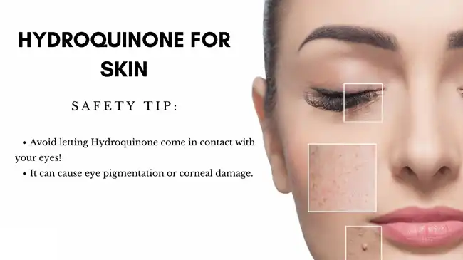 Hydroquinone for skin